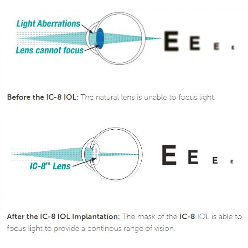 IC-8_spec