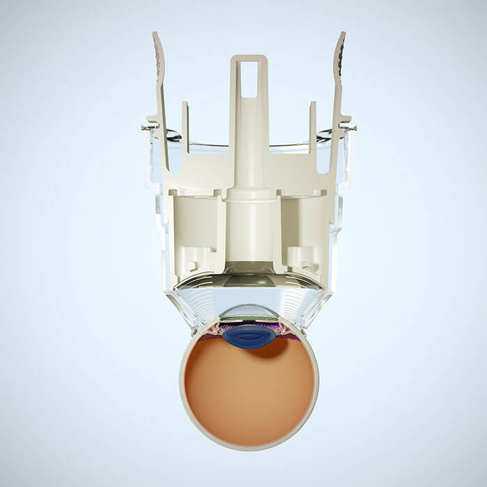 EyeTechCare-PixelDelune-Ultrasound_0005_Large_Frame01